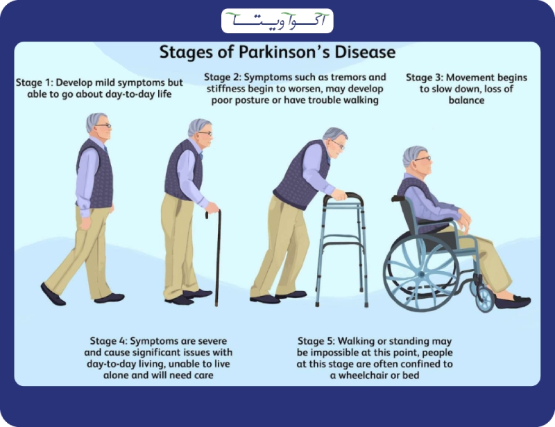 مراحل بیماری پارکینسون